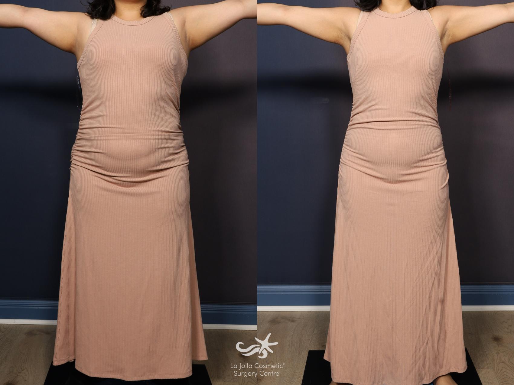 lipo c skinny shot reviews What is the Shot? Skinny Shots in Corpus Christi